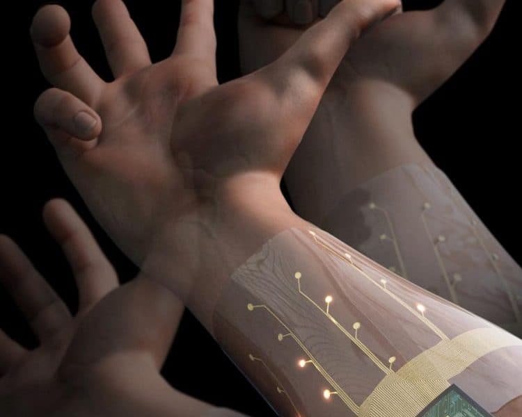 AI-supported wearable device could support prosthetics use