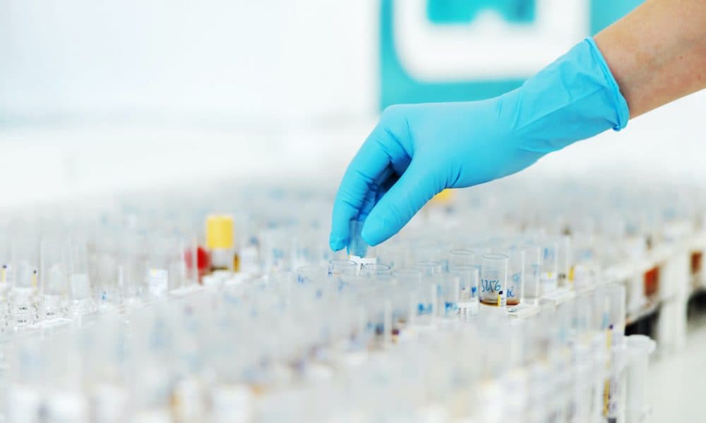 More than 10,000 NHS staff to submit test results on digital platform