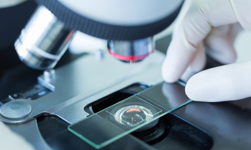 Computing technique developed for more accurate tumour biopsies