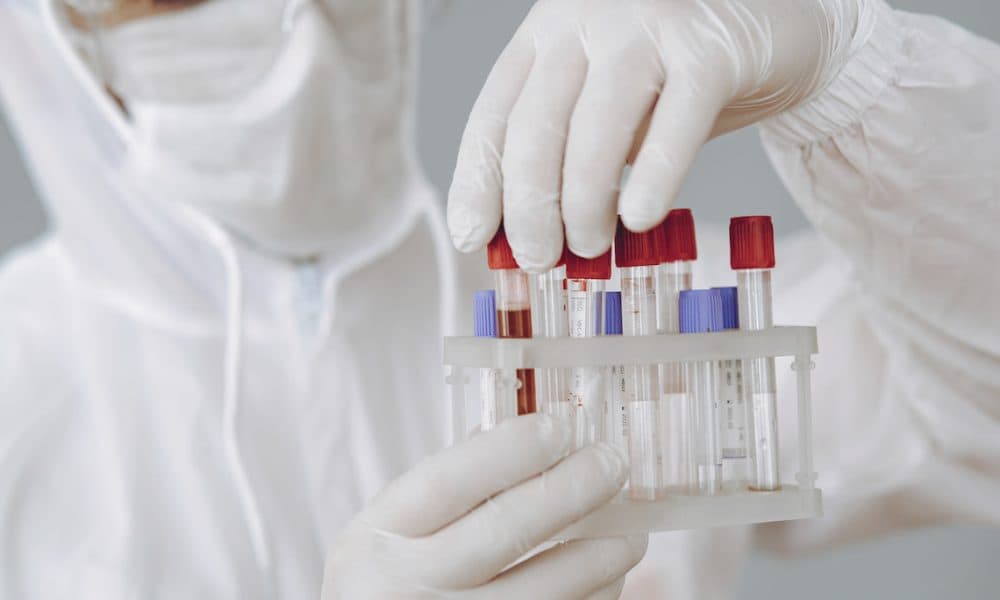 New rapid COVID-19 test aims to “get ahead of the curve”