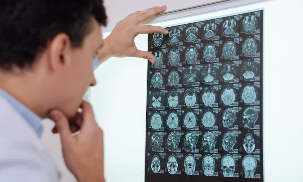 AI technology helps prevent cancer misdiagnosis