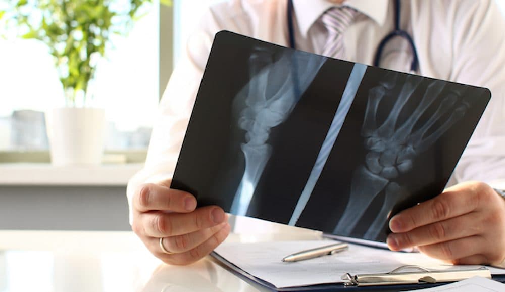 Automated booking service launched for NHS x-rays