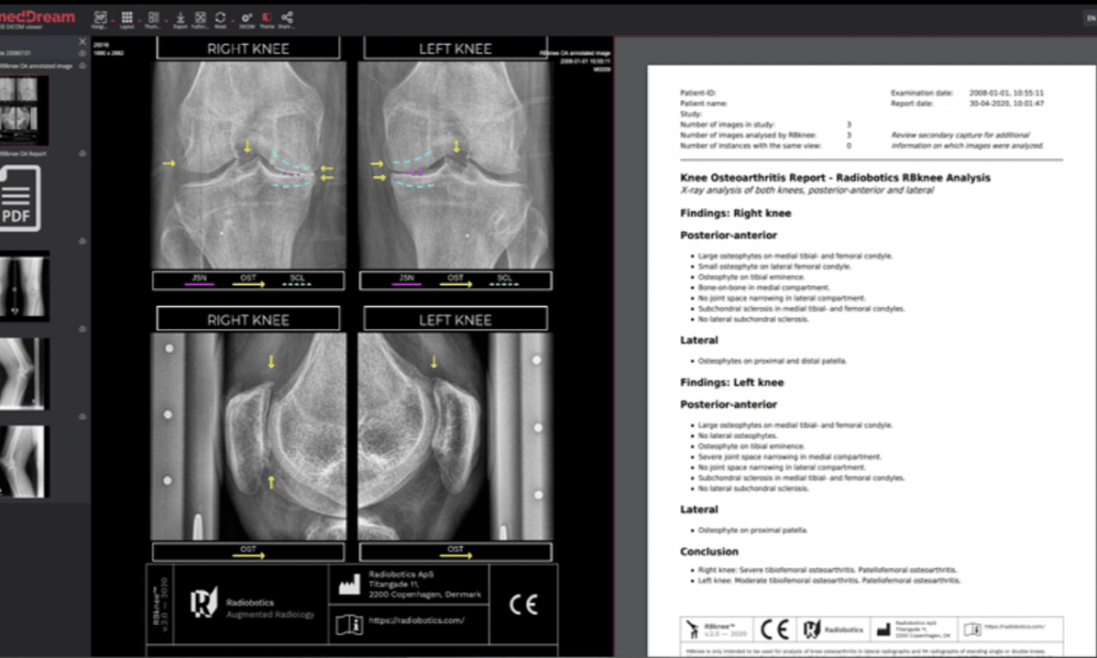 RBknee Radiobotics: “We’re on the cusp of a second wave of innovation”