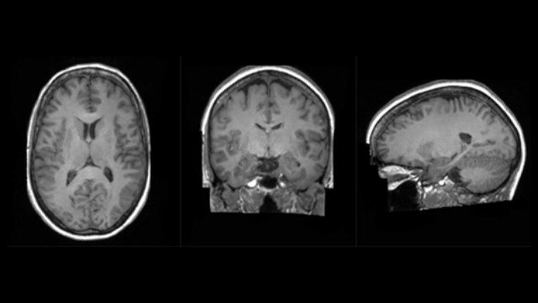Cambridge-1 pioneers AI-led 3D image brain analysis