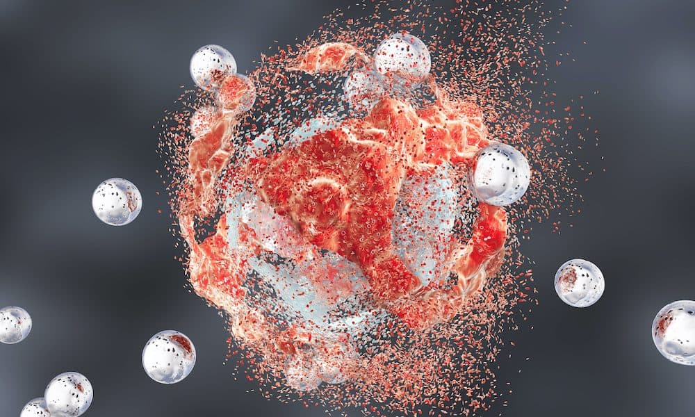 Nanoparticles suppress cancer treatment resistance