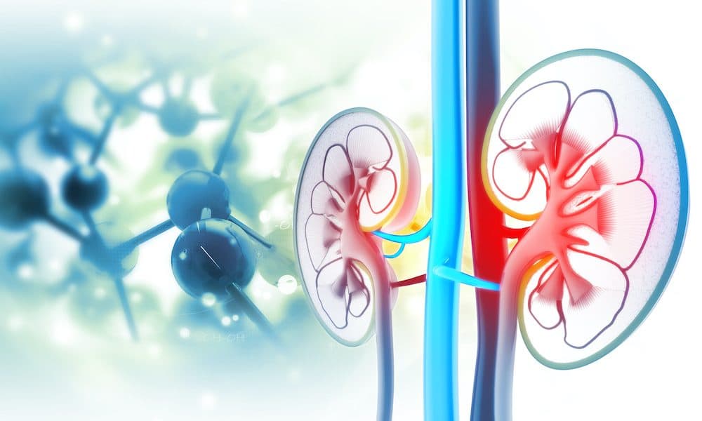 New AI tool in vascular access thrombosis fight