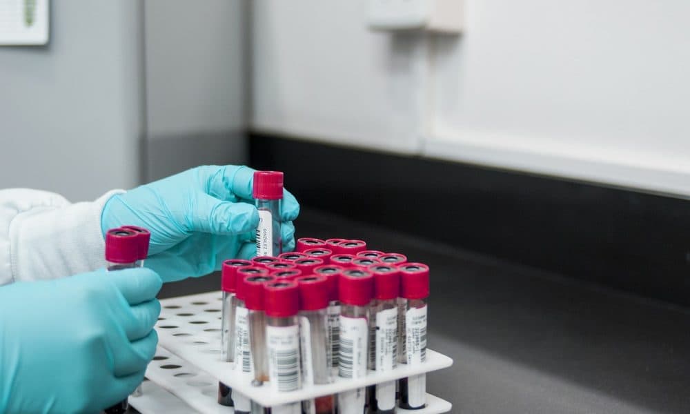 New blood test to identify type 1 diabetes