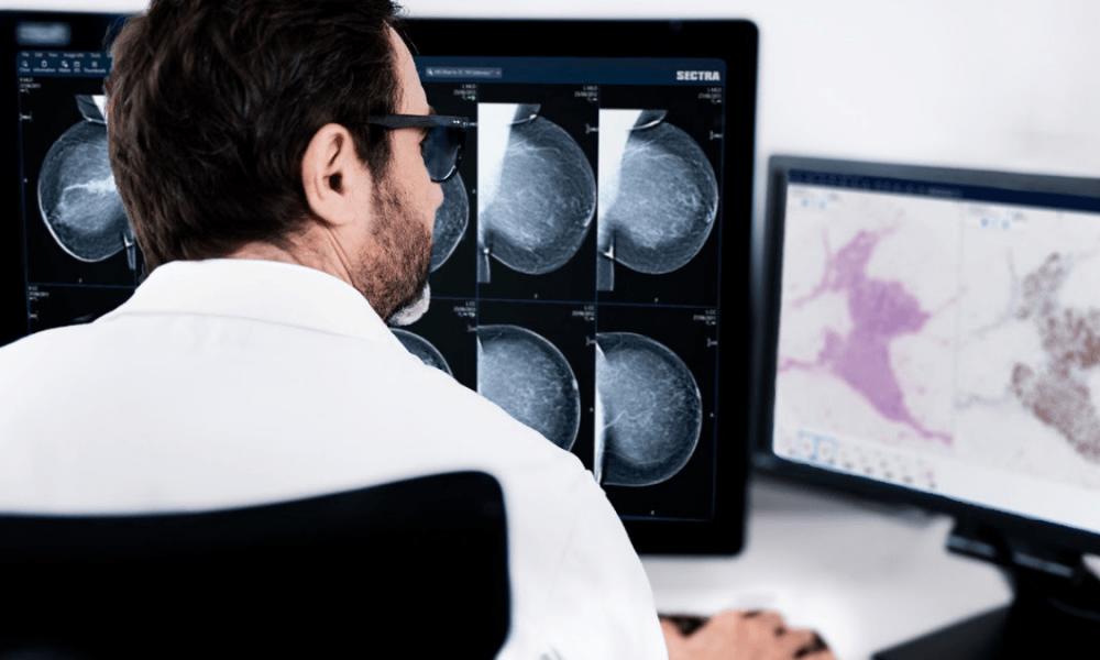 Northern Ireland digitises pathology with Sectra