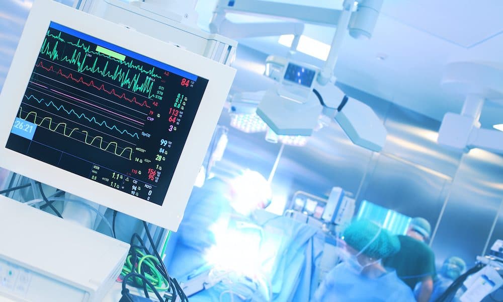 Monitoring heart rate during surgery AI heart monitoring cuts wait times