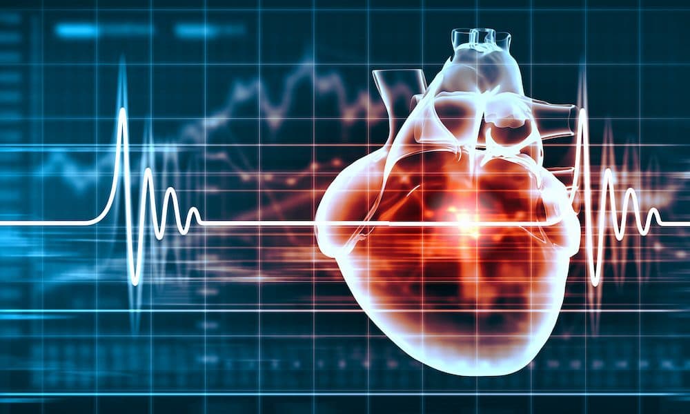 ac446546-951f-4cd3-b811-caba45405aa9 Programmable button drives faster heart attack care – study