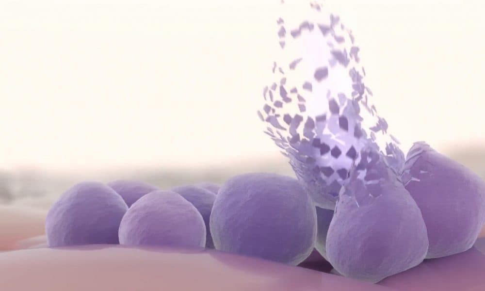 Enzyme kills Staphylococcus aureus without triggering resistance