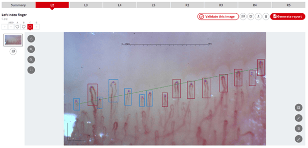 Capillary.io 2 Advancing capillaroscopy with Capillary.io