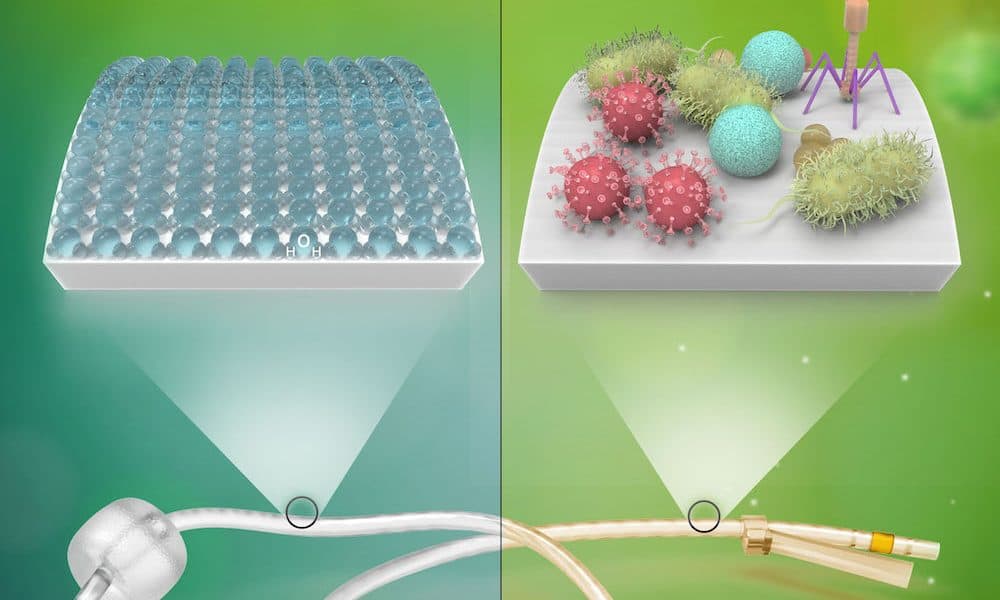 New surface treatment prevents hospital infections without antibiotics