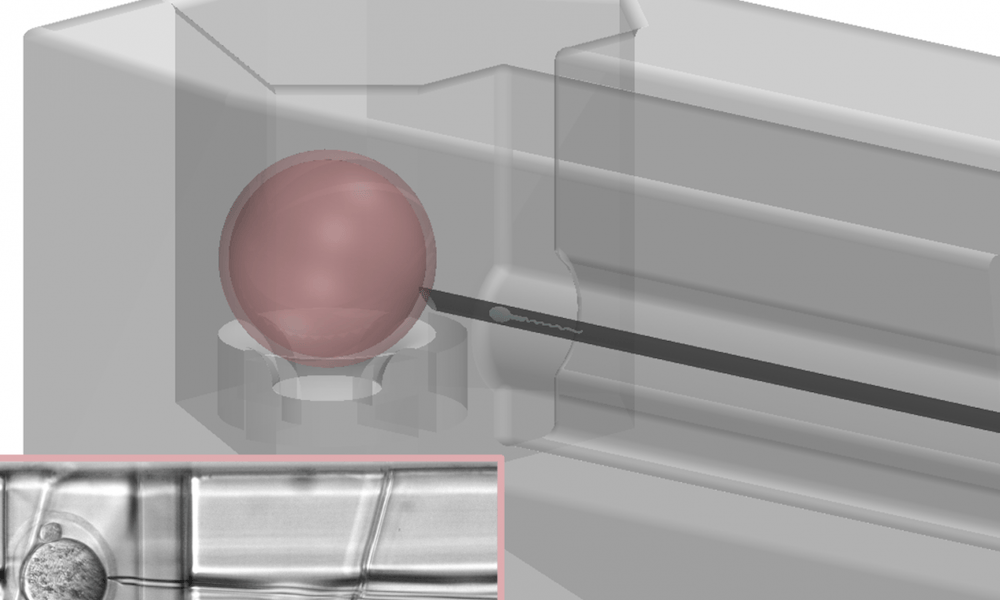 Micro-device streamlines male fertility treatment