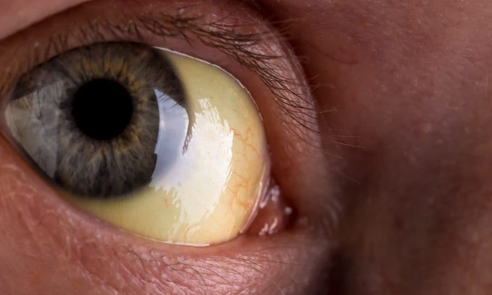 Deep learning model helps automated screening of common eye disorders