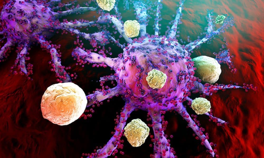 Synthetic receptor may cut need for chemo before cancer therapy