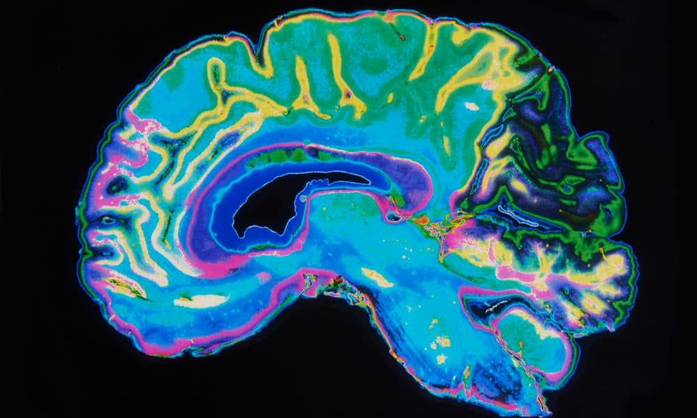 First expandable deep brain access port will help cancer surgeries