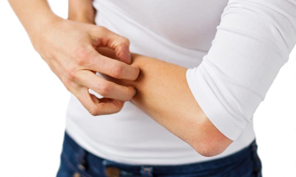 Therapy for severe childhood eczema will ‘revolutionise clinical practice worldwide’