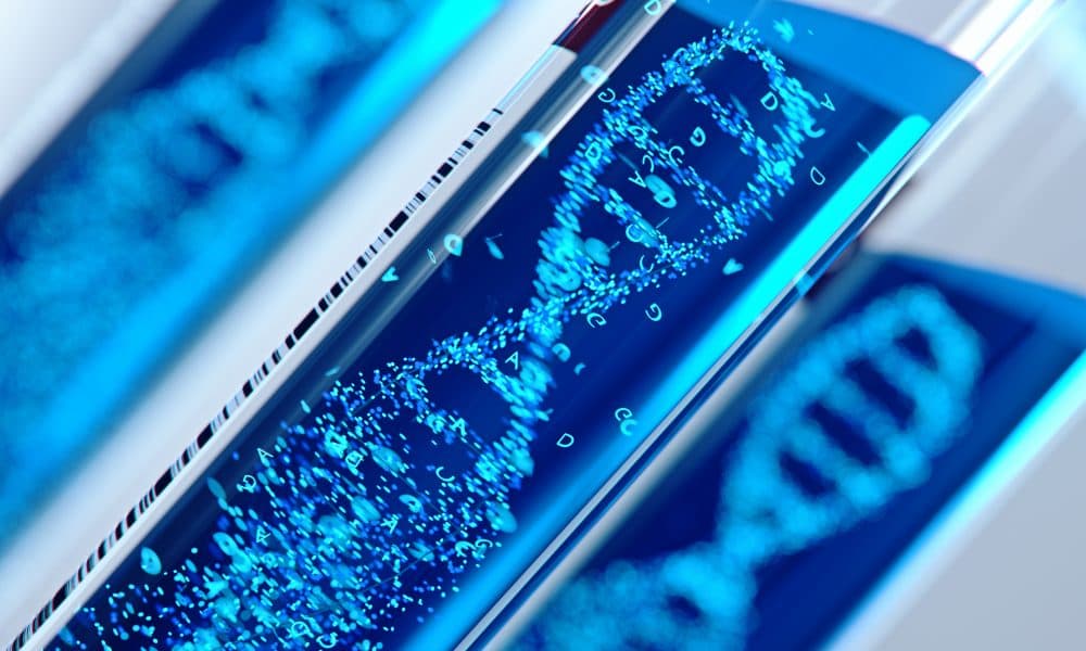 Genetic test could become new standard of care for stroke