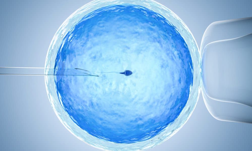How medtech will transform fertility treatment