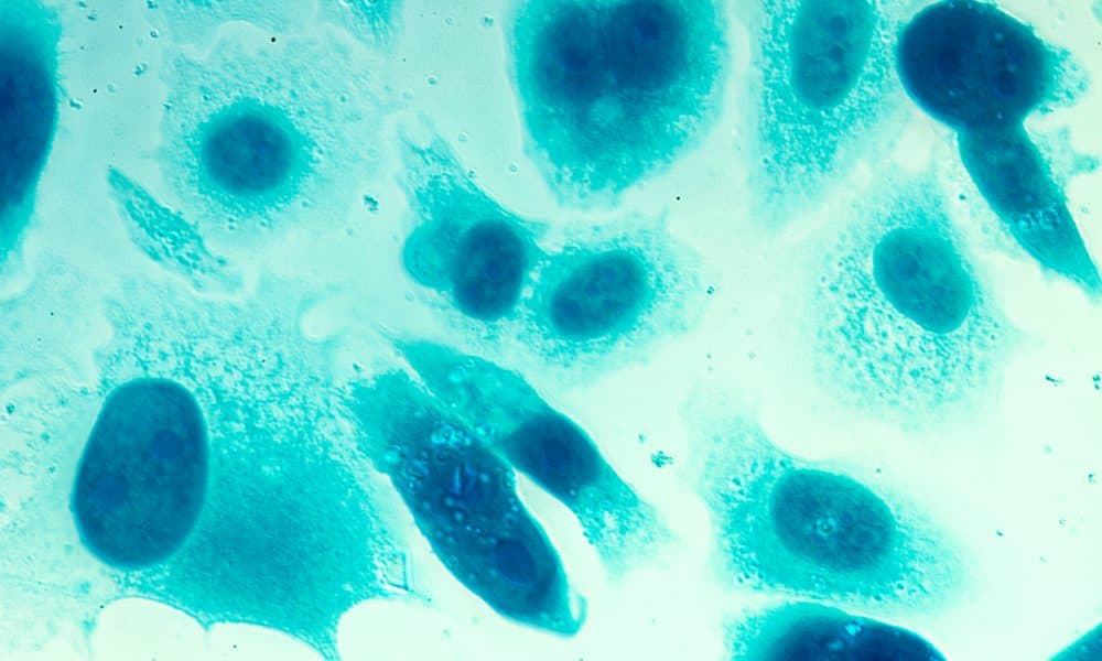 Robots help put brakes on inflammatory diseases