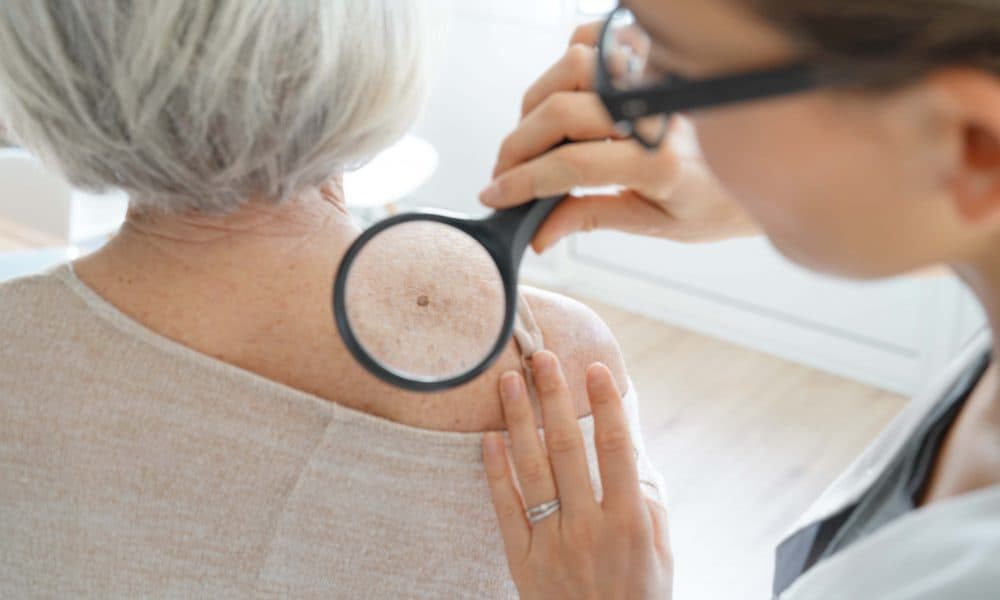 Senior woman getting skin checked by dermatologist Study reveals how incurable skin cancer resists treatment