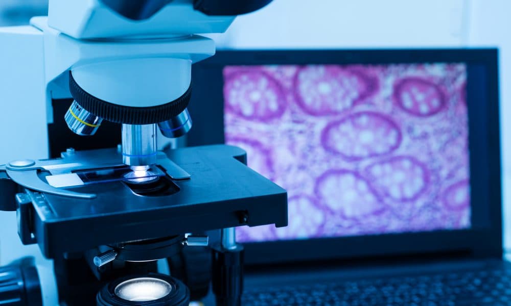 Modern microscope and human tissue section slide with computer m Greater Manchester advances digital pathology with Sectra