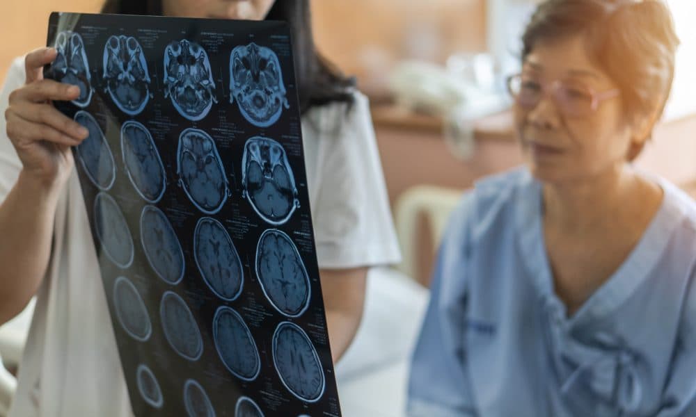 Brain disease diagnosis with medical doctor diagnosing elderly a Stroke diagnosis and the race to curb a growing epidemic
