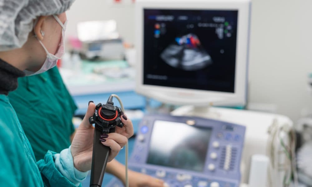 UK researchers develop new tool to reduce stroke risk