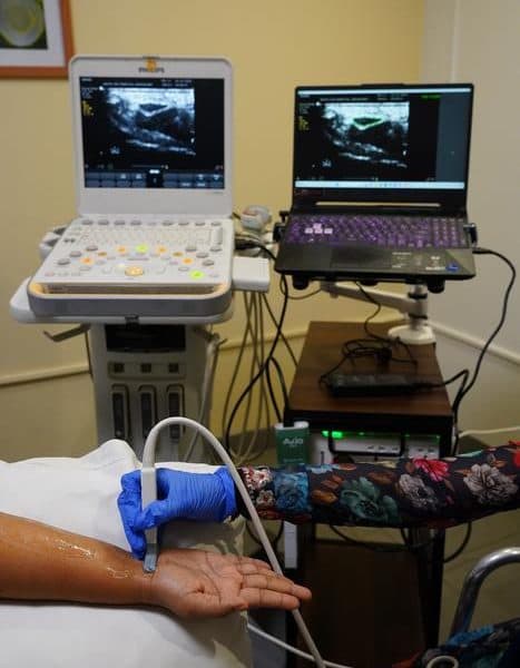 CTS AI aids in screening for nerve disorder