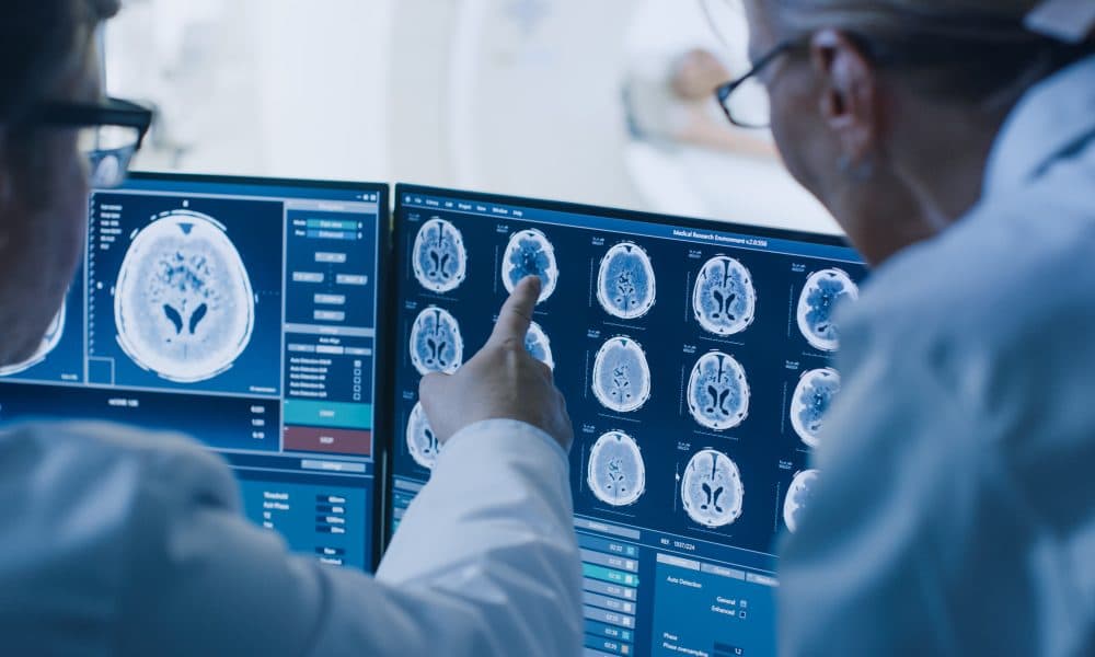 UK study offers hope for thousands impacted each year by aggressive brain cancer