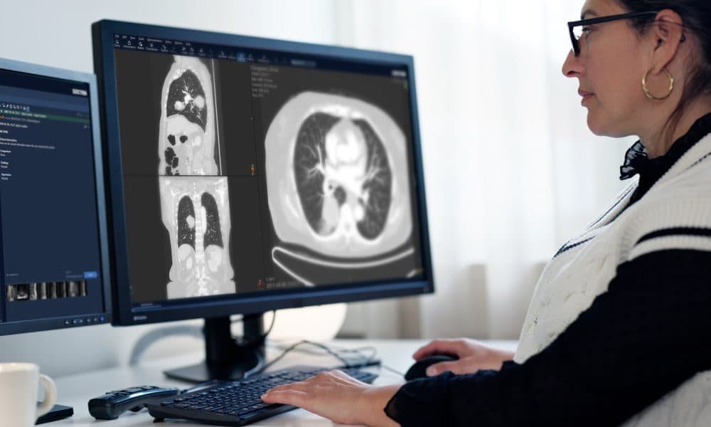 Greater Manchester reaches new milestone in go live to support faster diagnoses through PACS-based reporting