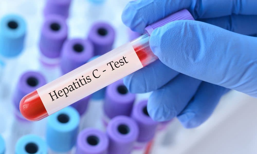 NHS expands ‘one-hour’ liver testing to help detect hepatitis C