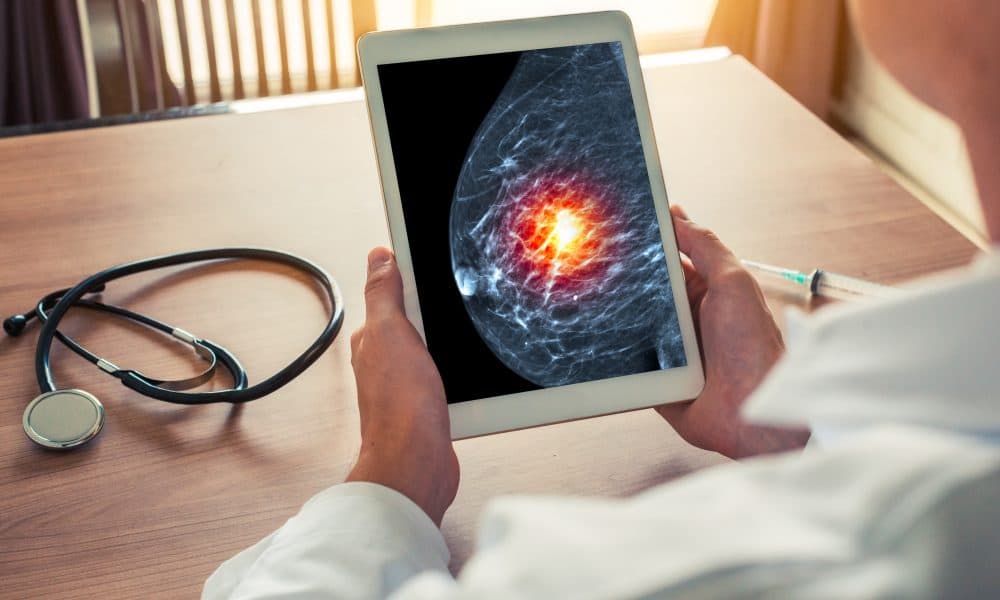 Doctor holding a digital tablet with xray mammogram skeleton. Breast cancer prevention Researchers uncover potential pathway to reducing breast cancer brain metastases
