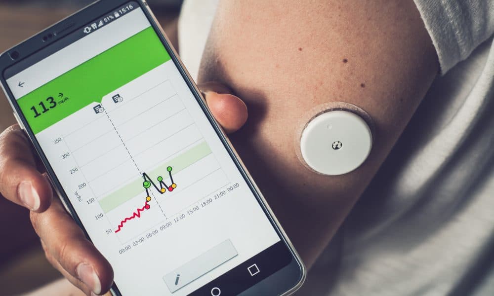 Glucose monitors need more regulation, study says