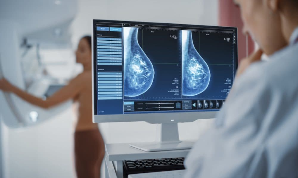 AI detects more breast cancers with fewer false positives