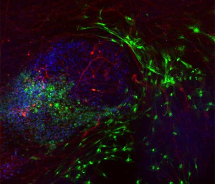 Low-Res_Image 1 Important step forward in stem cell therapy for rare bowel disease