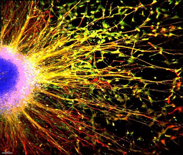 Low-Res_Mesci_705px Cancer drug could ease cognitive function for autism-linked condition