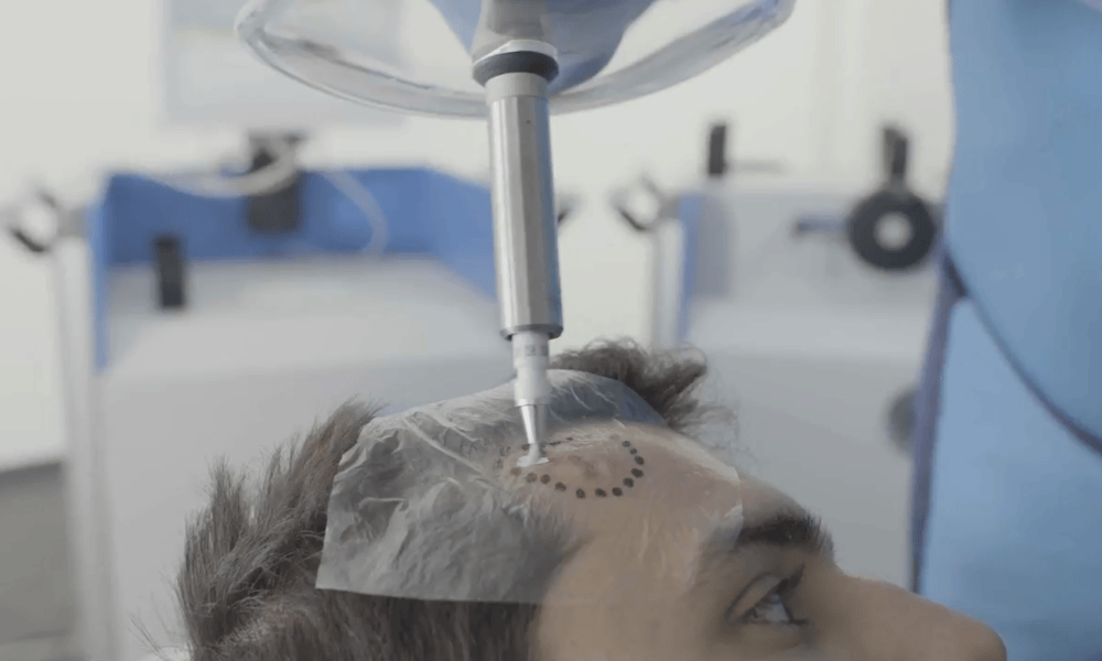 Patient having the treatment paste applied to the targeted area Innovative non-surgical skin cancer treatment offered at The London Clinic