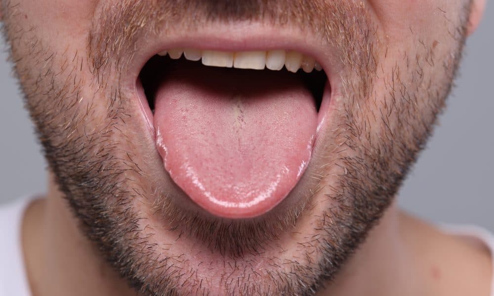 AdobeStock_715703766 Tongues could provide on-the-spot illness diagnoses