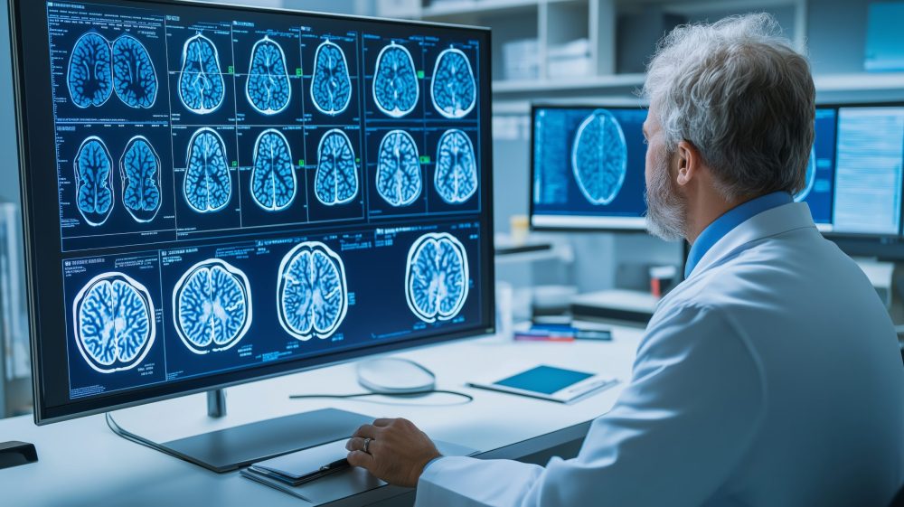 A medical professional analyzing brain scans on modern computer monitors in a high-tech clinic. New genetic test can diagnose brain tumours in as little as two hours