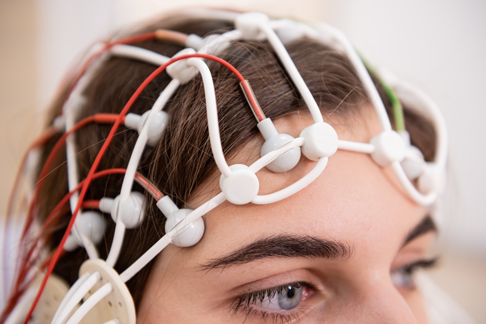 Personalised brain stimulation shows depression benefits