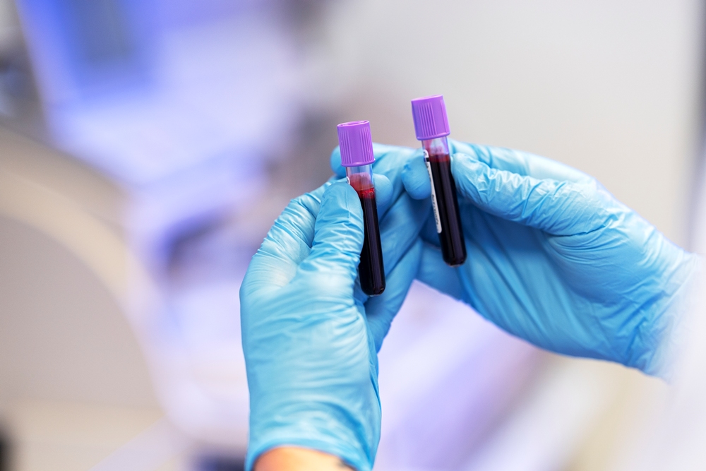 doctor-performing-medical-research-lab Researchers develop first accurate blood test for chronic fatigue syndrome