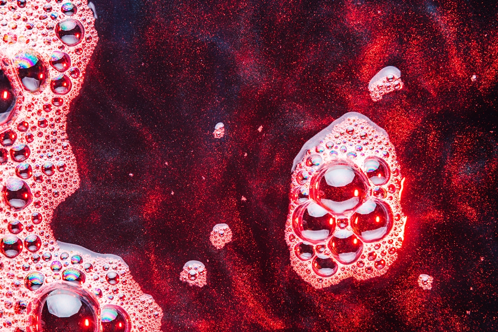 AI breakthroughs predict painful crises in sickle cell disease before they strike