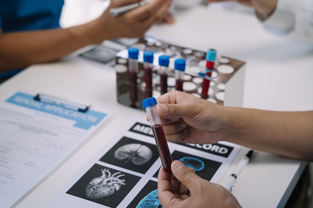 AI model can detect multiple cognitive diseases from single blood sample