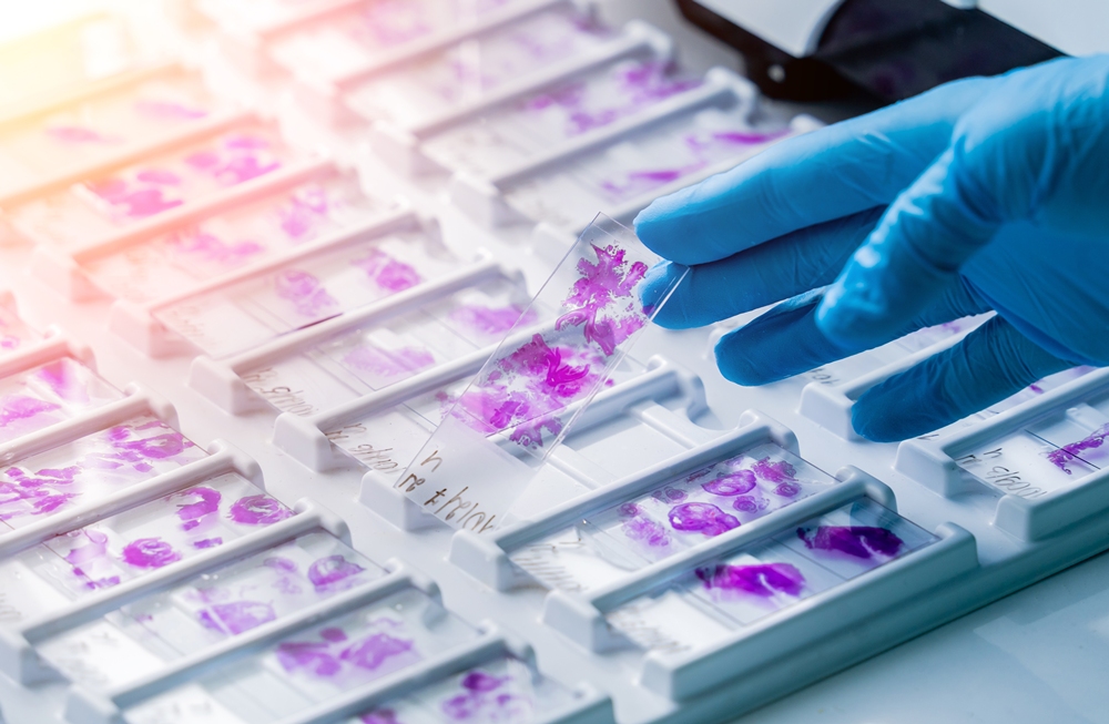 Hand in blue glove holding glass histology slides What a karyotype actually shows: when it’s offered, and what it can and can’t tell you